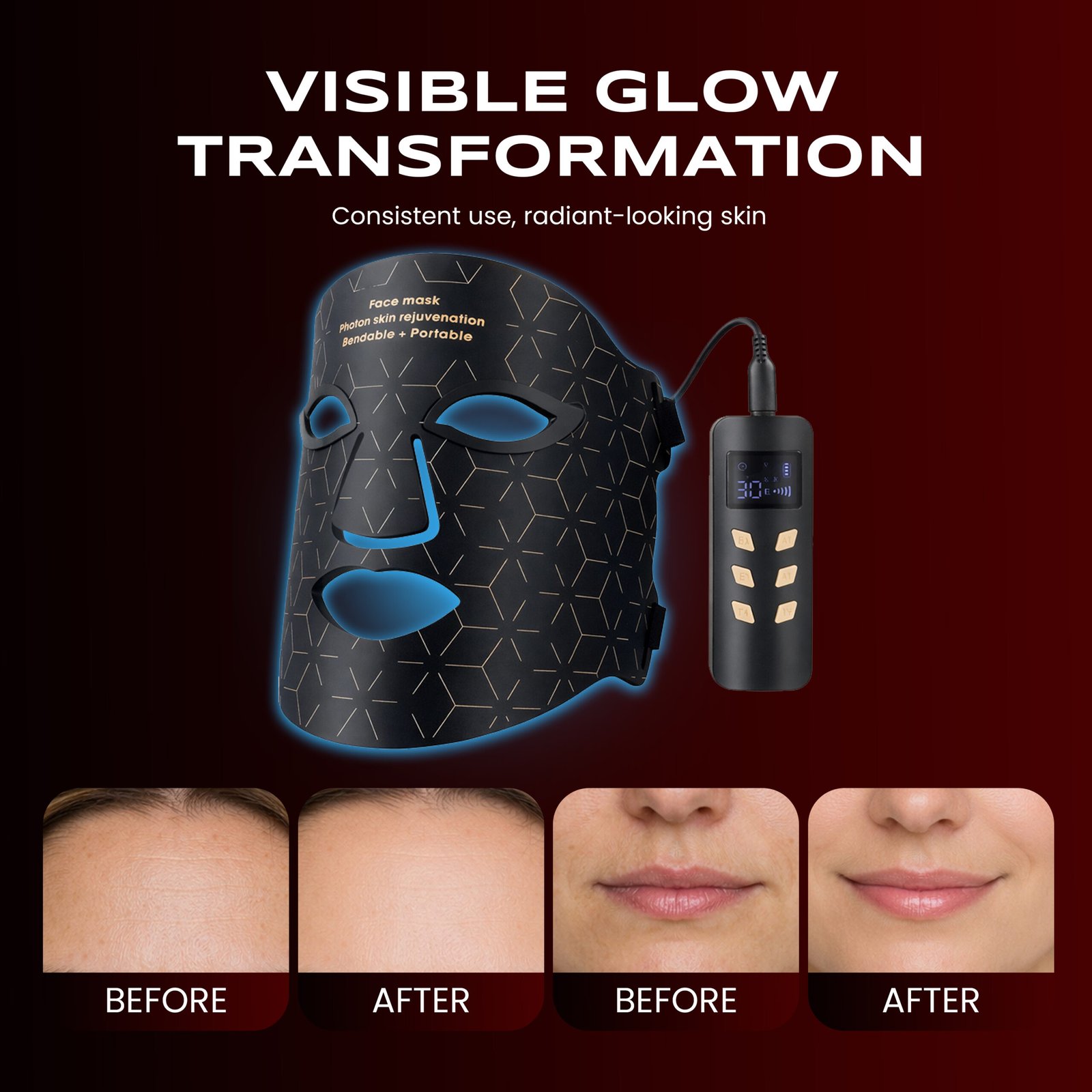 Visible Glow Transformation. Before and after usage comparison of Trendlox LED Light Face Mask Visible Glow Transformation. Before and after usage comparison of Trendlox LED Light Face Mask