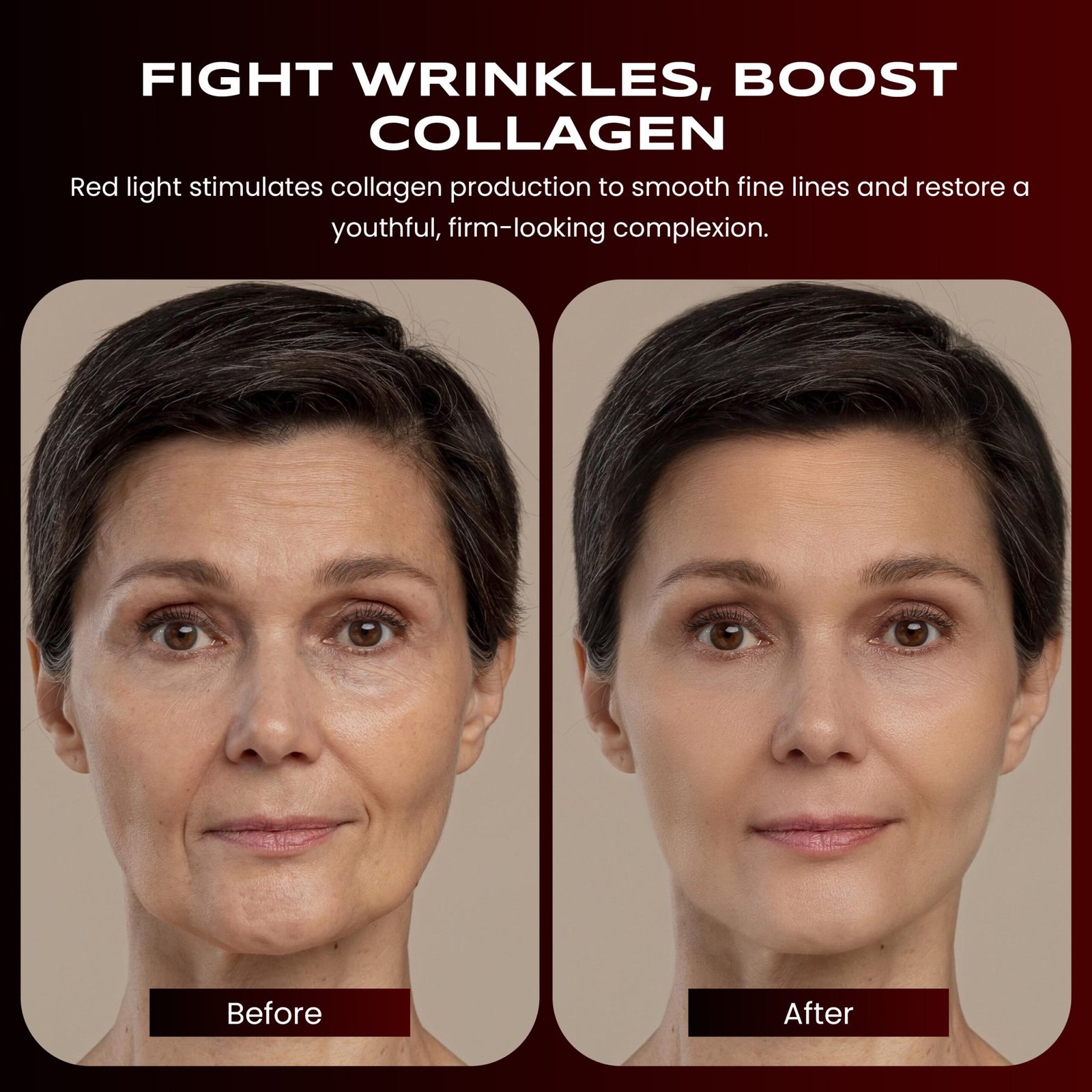 Before and after comparison. Fight Wrinkles, Boost Collagen Before and after comparison. Fight Wrinkles, Boost Collagen
